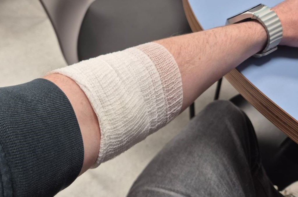 Arm mit Binde verbunden